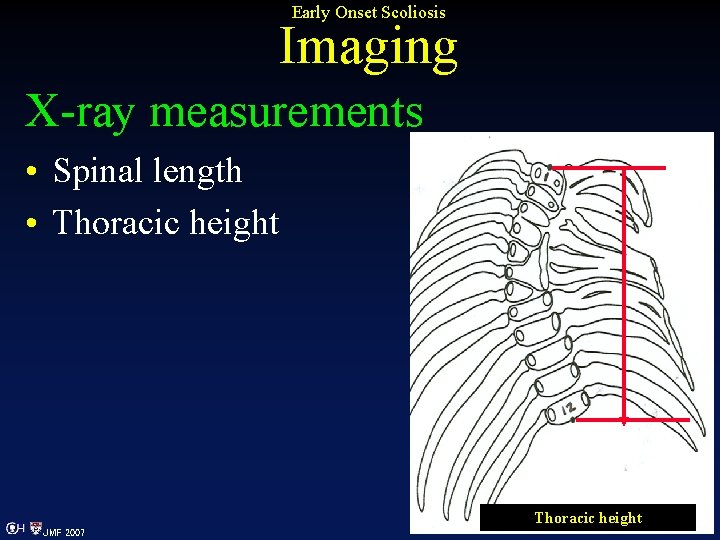 Early Onset Scoliosis Imaging X-ray measurements • Spinal length • Thoracic height JMF 2007