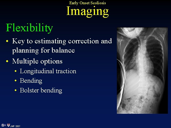 Early Onset Scoliosis Imaging Flexibility • Key to estimating correction and planning for balance