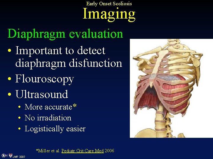 Early Onset Scoliosis Imaging Diaphragm evaluation • Important to detect diaphragm disfunction • Flouroscopy