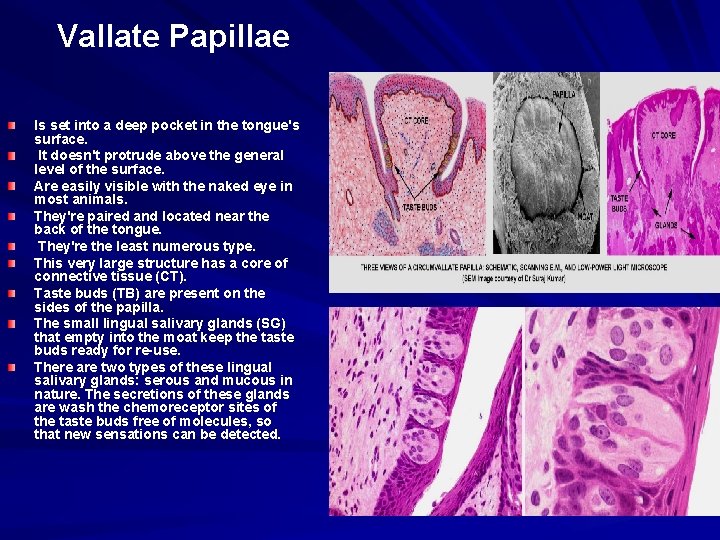 Vallate Papillae Is set into a deep pocket in the tongue's surface. It doesn't