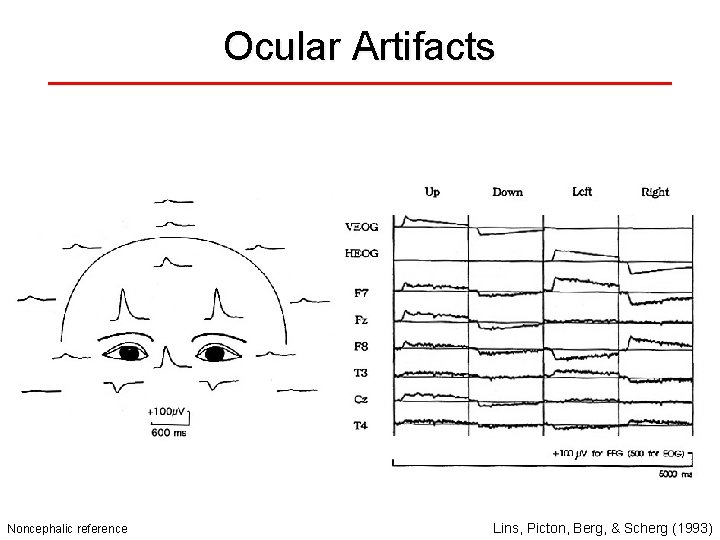 Ocular Artifacts Noncephalic reference Lins, Picton, Berg, & Scherg (1993) 