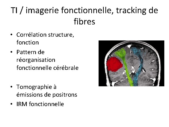TI / imagerie fonctionnelle, tracking de fibres • Corrélation structure, fonction • Pattern de