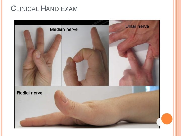 CLINICAL HAND EXAM Median nerve Radial nerve Ulnar nerve 
