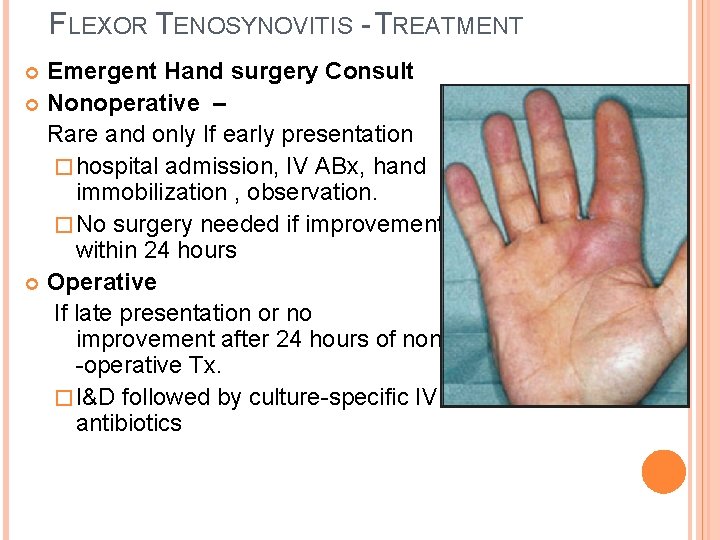 FLEXOR TENOSYNOVITIS - TREATMENT Emergent Hand surgery Consult Nonoperative – Rare and only If