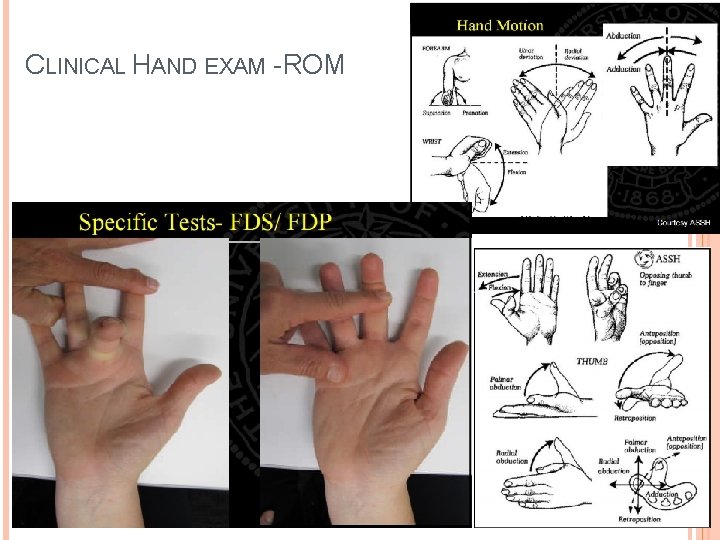 CLINICAL HAND EXAM - ROM 