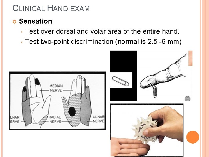 CLINICAL HAND EXAM Sensation • Test over dorsal and volar area of the entire