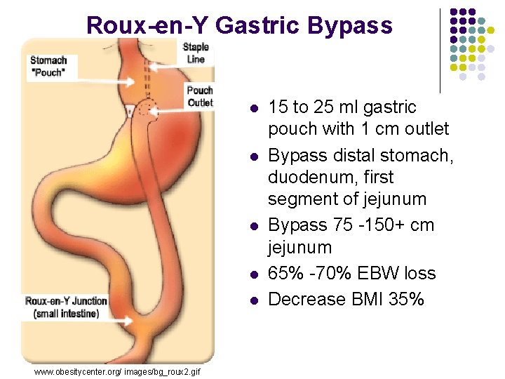 Roux-en-Y Gastric Bypass l l l www. obesitycenter. org/ images/bg_roux 2. gif 15 to