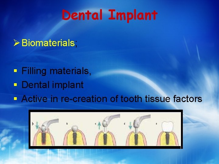 Dental Implant Biomaterials; § Filling materials, § Dental implant § Active in re-creation of