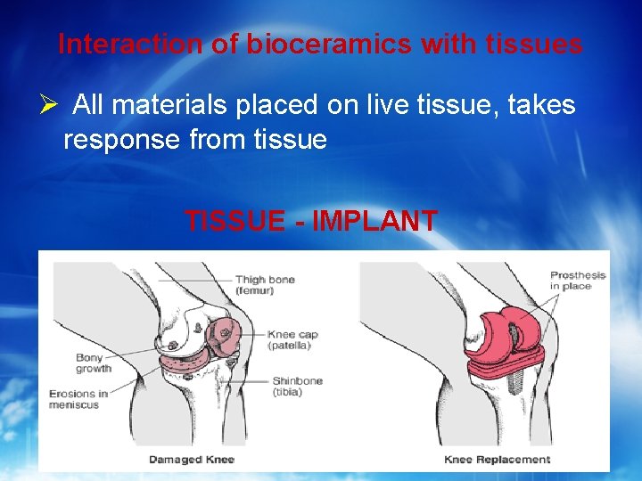 Interaction of bioceramics with tissues All materials placed on live tissue, takes response from