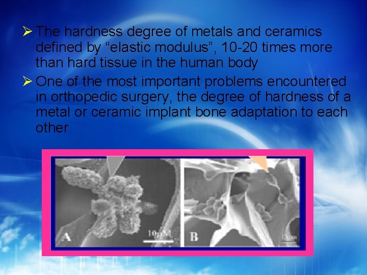  The hardness degree of metals and ceramics defined by “elastic modulus”, 10 -20