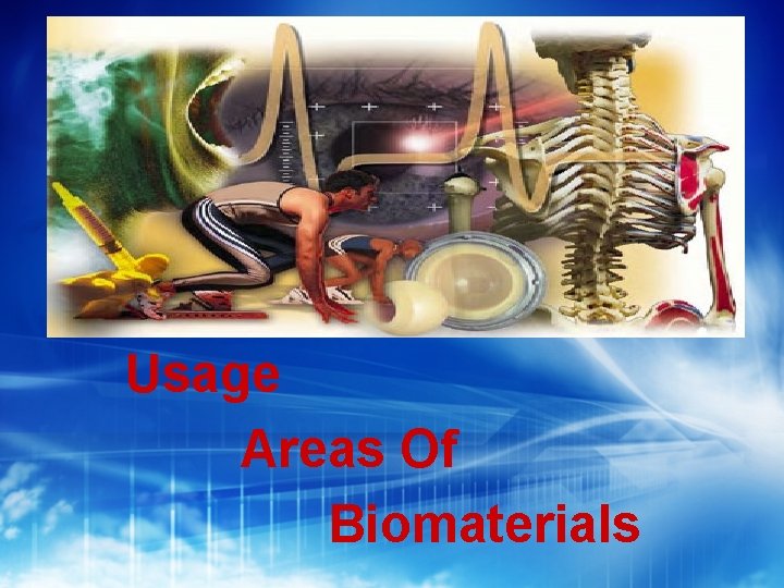 Usage Areas Of Biomaterials 