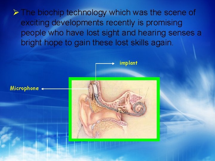  The biochip technology which was the scene of exciting developments recently is promising