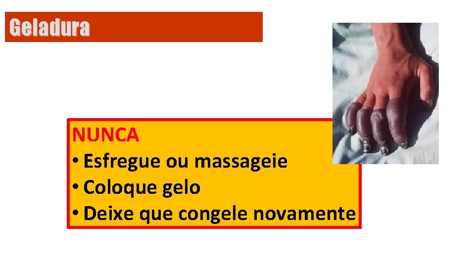 Geladura NUNCA • Esfregue ou massageie • Coloque gelo • Deixe que congele novamente