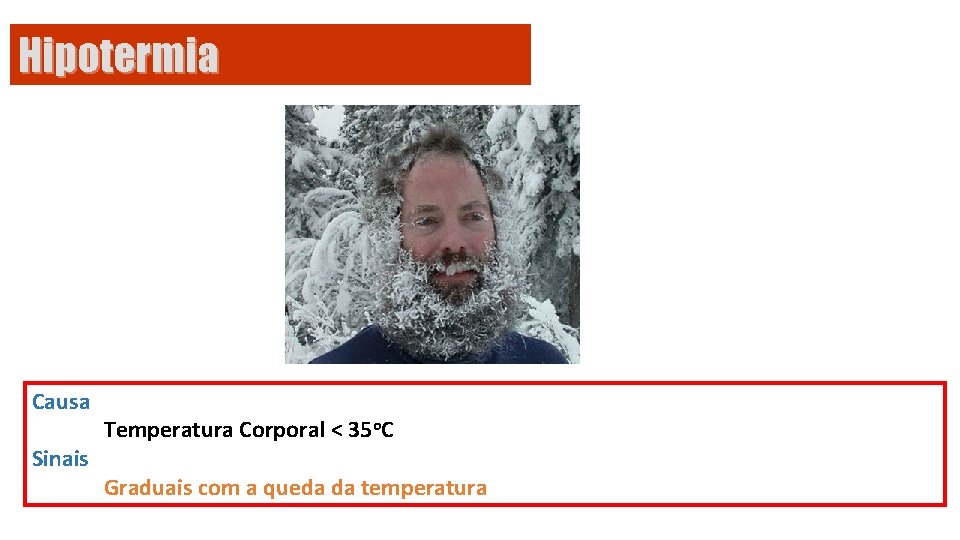 Hipotermia Causa Sinais Temperatura Corporal < 35 o. C Graduais com a queda da