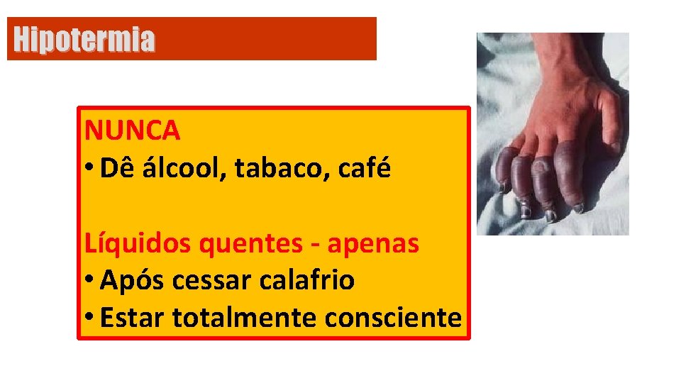 Hipotermia NUNCA • Dê álcool, tabaco, café Líquidos quentes - apenas • Após cessar