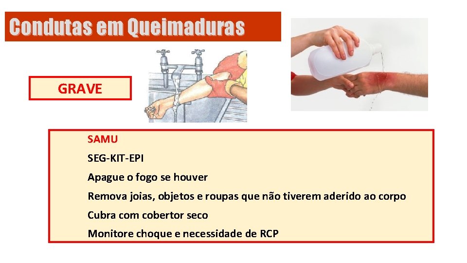 Condutas em Queimaduras GRAVE SAMU SEG-KIT-EPI Apague o fogo se houver Remova joias, objetos