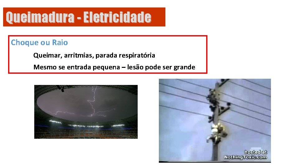 Queimadura - Eletricidade Choque ou Raio Queimar, arritmias, parada respiratória Mesmo se entrada pequena