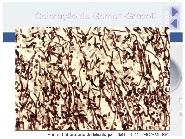 Coloração de Gomori-Grocott Fonte: Laboratório de Micologia – IMT – LIM – HC/FMUSP 