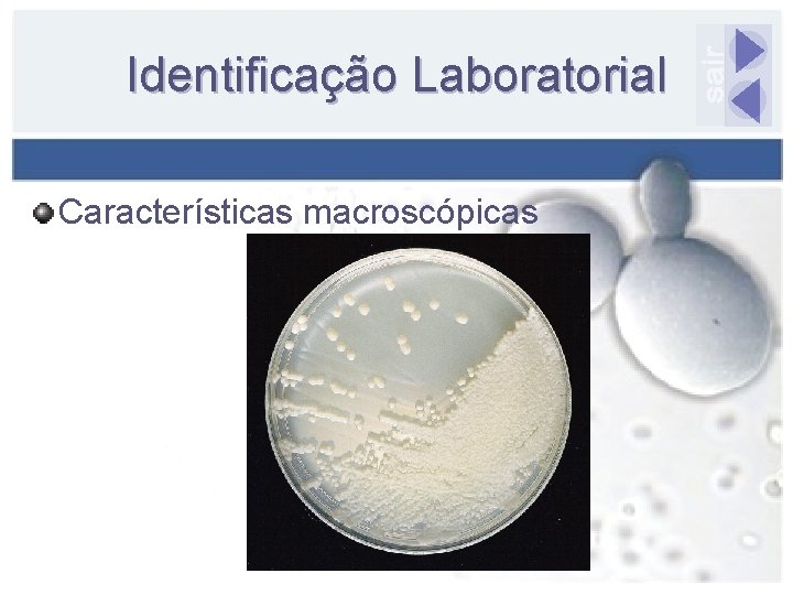 Identificação Laboratorial Características macroscópicas 