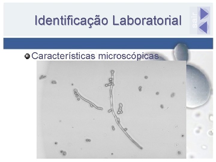 Identificação Laboratorial Características microscópicas 