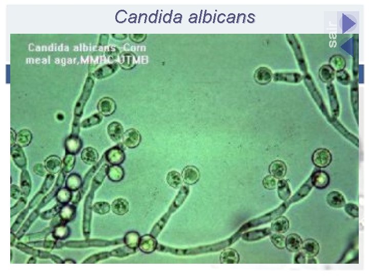 Candida albicans 