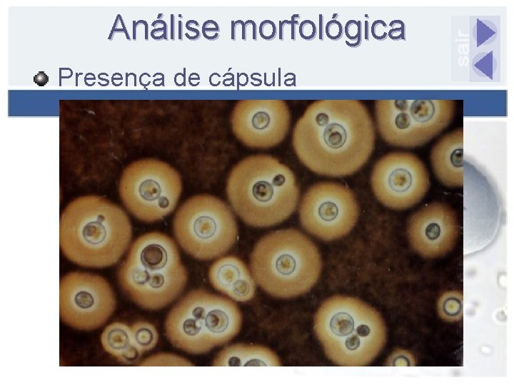Análise morfológica Presença de cápsula 