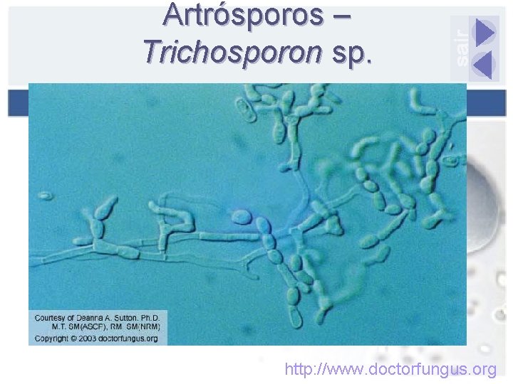 Artrósporos – Trichosporon sp. http: //www. doctorfungus. org 
