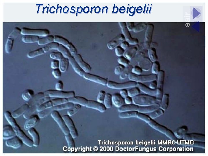 Trichosporon beigelii 