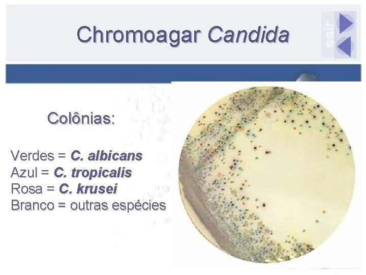 Chromoagar Candida Colônias: Verdes = C. albicans Azul = C. tropicalis Rosa = C.