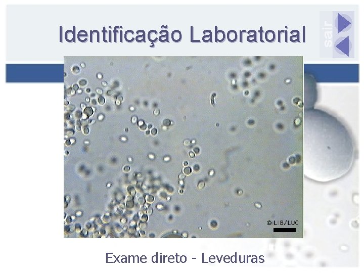 Identificação Laboratorial Exame direto - Leveduras 