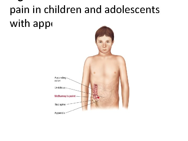 pain in children and adolescents with appendicitis. 