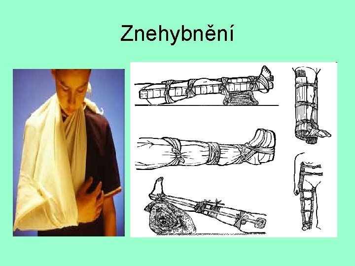 Znehybnění 