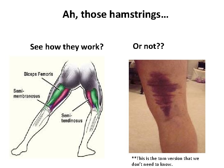 Ah, those hamstrings… See how they work? Or not? ? **This is the torn