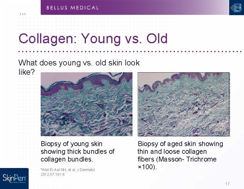 1. 1 1 Collagen: Young vs. Old What does young vs. old skin look
