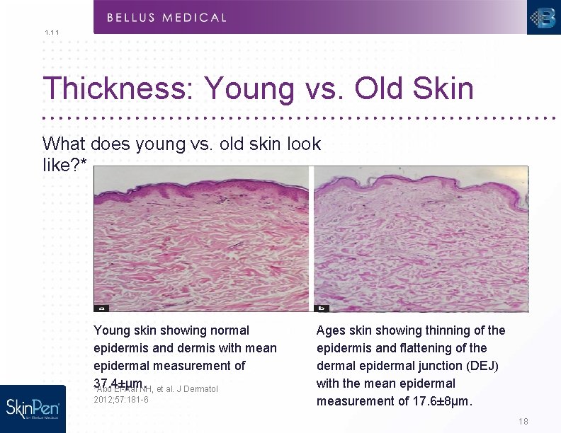 1. 1 1 Thickness: Young vs. Old Skin What does young vs. old skin
