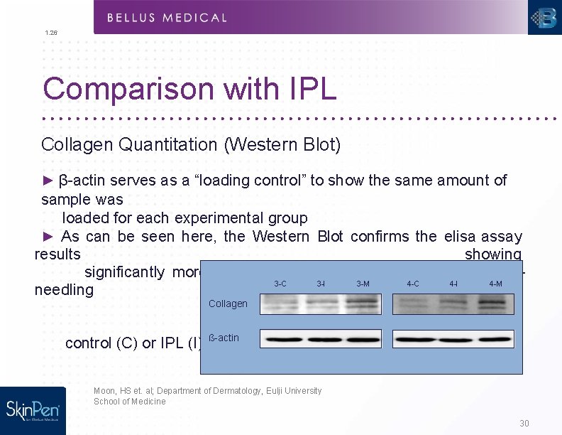 1. 26 Comparison with IPL Collagen Quantitation (Western Blot) ► β-actin serves as a