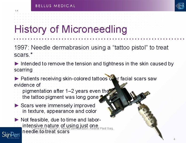 1. 4 History of Microneedling 1997: Needle dermabrasion using a “tattoo pistol” to treat