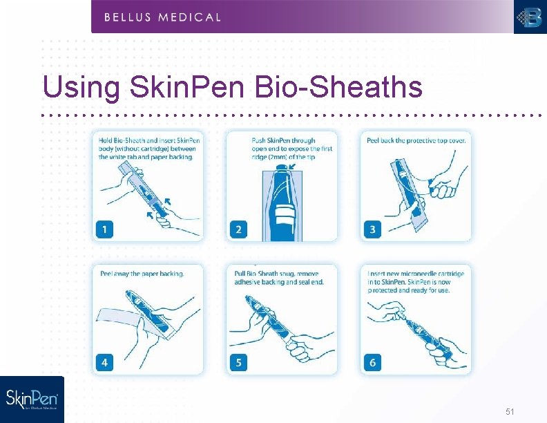 Using Skin. Pen Bio-Sheaths 51 
