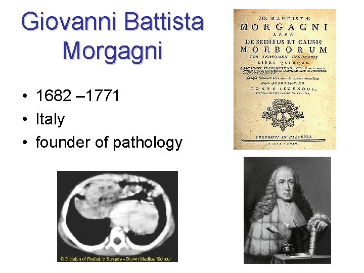 Giovanni Battista Morgagni • 1682 – 1771 • Italy • founder of pathology 