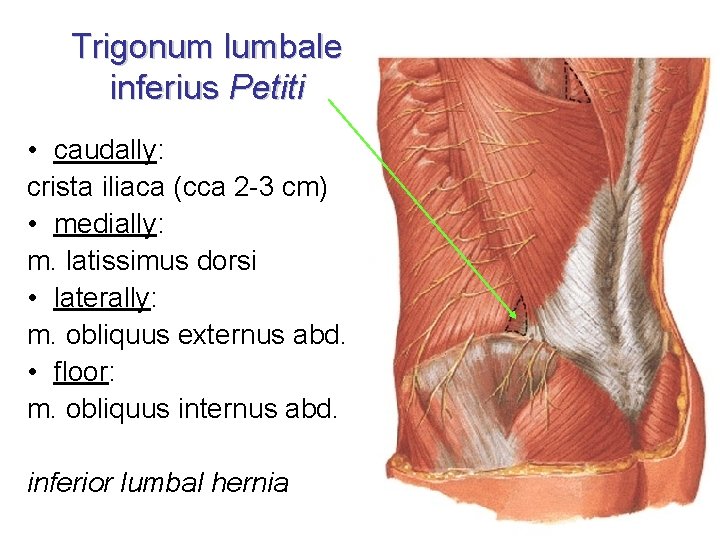 Trigonum lumbale inferius Petiti • caudally: crista iliaca (cca 2 -3 cm) • medially: