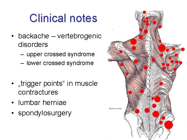 Clinical notes • backache – vertebrogenic disorders – upper crossed syndrome – lower crossed