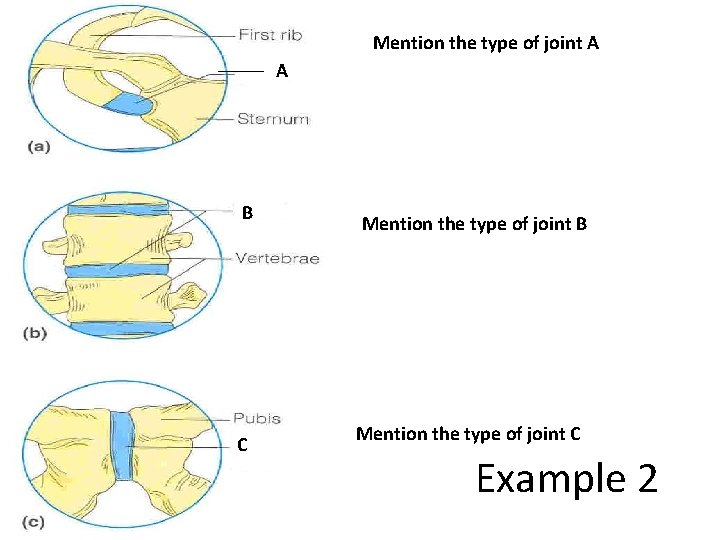 Mention the type of joint A A B C Mention the type of joint