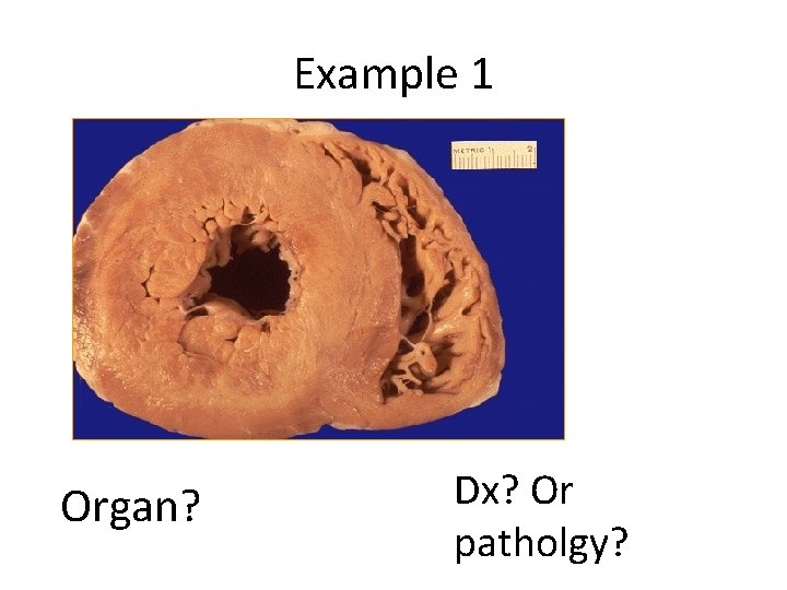 Example 1 Organ? Dx? Or patholgy? 