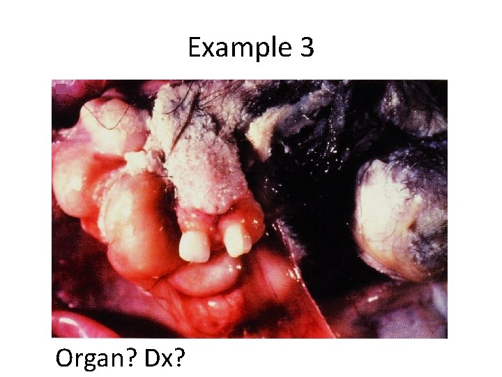 Example 3 Organ? Dx? 