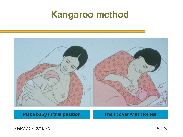 Kangaroo method Place baby in this position Teaching Aids: ENC Then cover with clothes