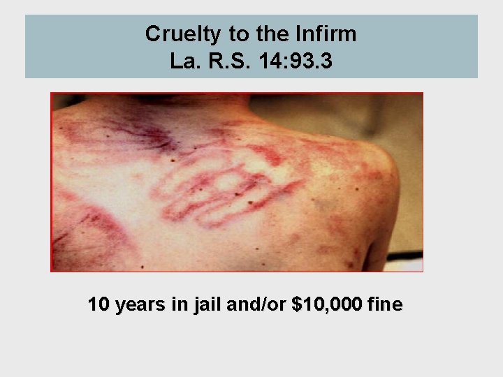 Cruelty to the Infirm La. R. S. 14: 93. 3 10 years in jail