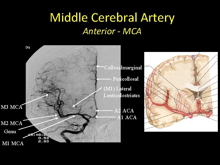 Middle Cerebral Artery Anterior - MCA Collosalmarginal Pericollosal (M 1) Lateral Lenticulostriates M 3