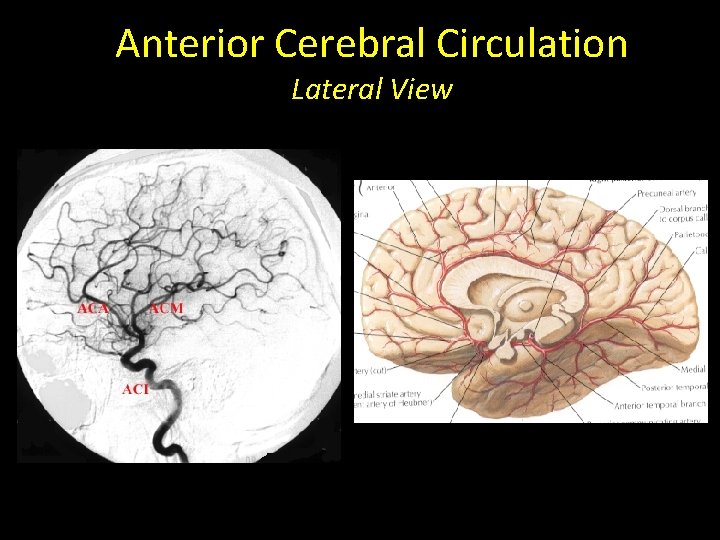 Anterior Cerebral Circulation Lateral View 