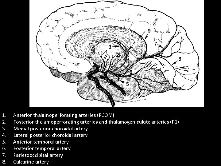 1. 2. 3. 4. 5. 6. 7. 8. Anterior thalamoperforating arteries (PCOM) Posterior thalamoperforating