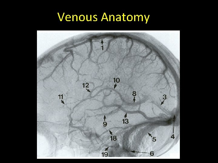 Venous Anatomy 